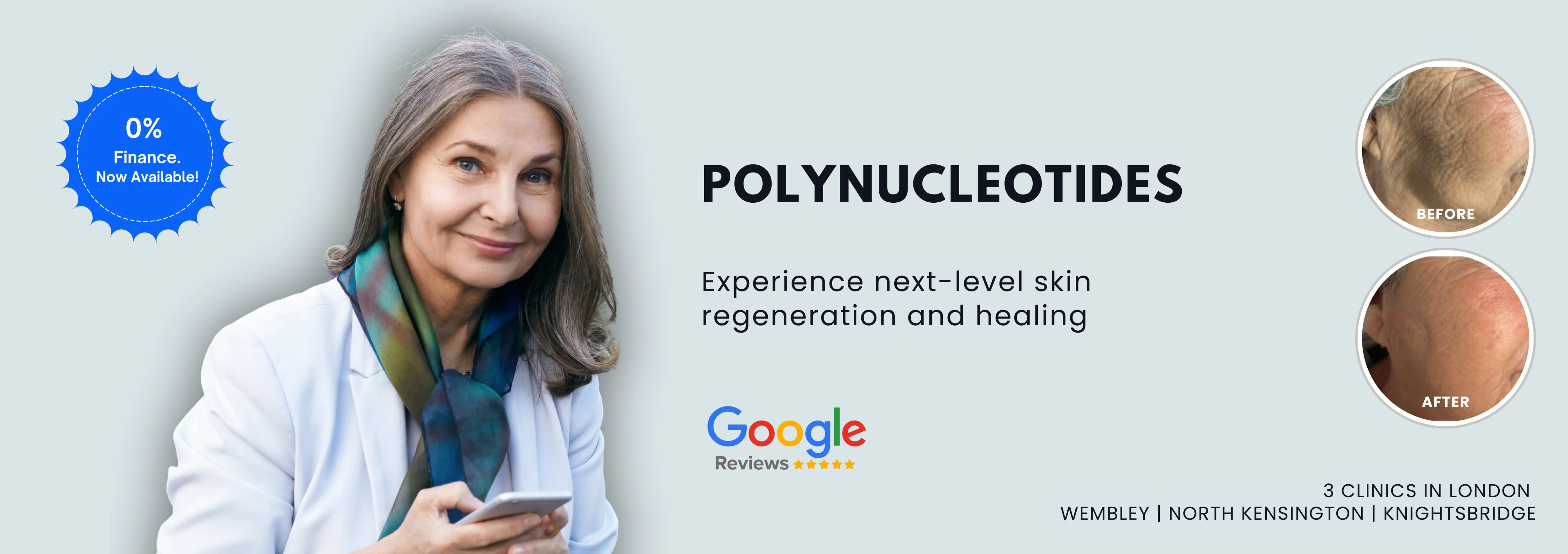 Polynucleotides