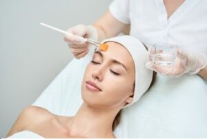 Cosmetic Grade Peels