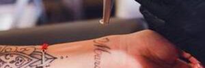 Laser Tattoo Removal